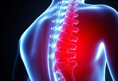 Anzeichen eines Bandscheibenvorfalls: Worauf Sie achten sollten