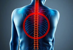 Schmerzfrei durch gezielte McKenzie-Übungen bei Bandscheibenvorfall