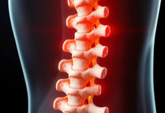 Erkennen und verstehen: die ersten Anzeichen einer spinalkanalstenose