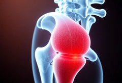 Leben ohne Schmerz: Wege aus dem Bandscheibenprolaps