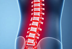 Einbruch im Rücken: Ursachen, Symptome und moderne Behandlungsmöglichkeiten