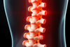 Erkennen und verstehen: die ersten Anzeichen einer spinalkanalstenose