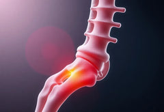 Linderung für den unteren Rücken: effektive Behandlungsmethoden bei arthrose lws