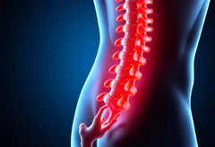 Linderung bei bandscheibenvorwölbung L5/S1: effektive Therapien und Tipps für den Alltag