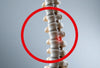 Spondylose verstehen und den Rücken stärken