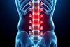 Lumbale spinalstenose: schmerzen lindern und mobilität gewinnen