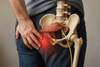 Piriformis-Syndrom: Linderung finden und wieder schmerzfrei leben