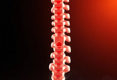 Wenn der Nacken schmerzt: Symptome der arthrose in der halswirbelsäule erkennen und lindern